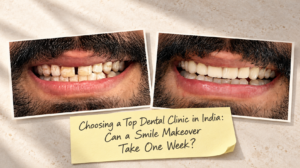 Can a Smile Makeover Take Only One Week?